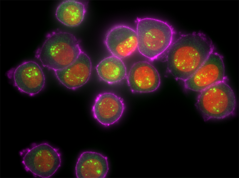 Simultaneous RNA FISH and Immunofluorescence